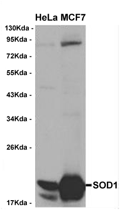 SOD1 antibody (AB19-10106) WB of HeLa and MCF7 cellsat 1:1000